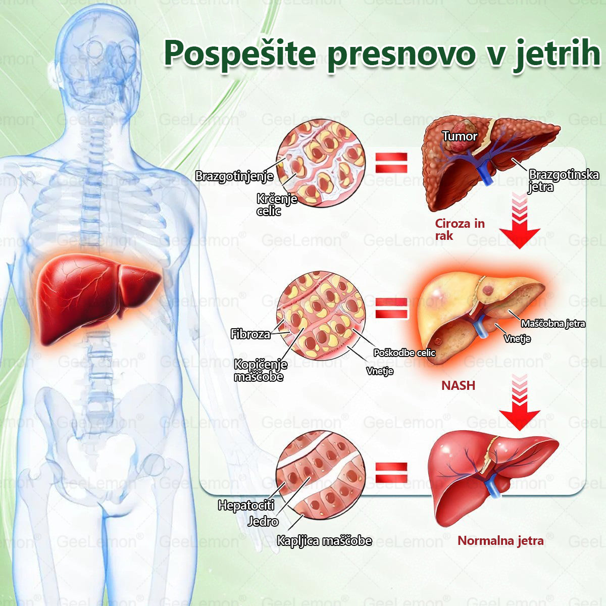 🌴Registrirano pri JAZMP in GMP certificirano👩‍⚕️🎁 𝐆𝐞𝑒𝐿𝑒𝐦𝐨𝐧® 𝐆𝐥𝐮𝐦𝐚𝐬𝐞𝐭𝐢𝐝𝐞 8 v 1 Hujševalni in zdravju namenjen nano obliž z mikroiglicami 🇸🇮 (Samo enkrat na dan, vidne spremembe že v 7 dneh) ✅