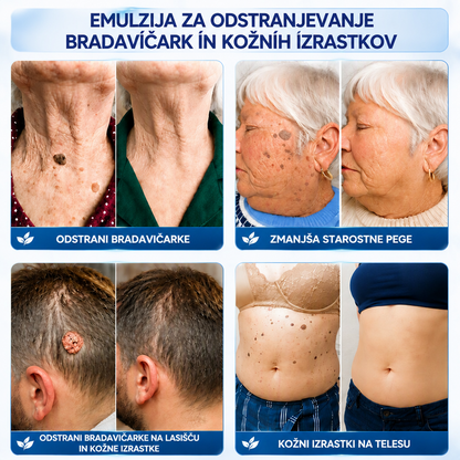 𝐇𝐈𝐒𝐊𝐈𝐍® 𝟕-𝐝𝐧𝐞𝐯𝐧𝐚 𝐤𝐫𝐞𝐦𝐚 𝐳𝐚 𝐤𝐨ž𝐧𝐞 𝐢𝐳𝐫𝐚𝐬𝐭𝐤𝐞 & 𝐩𝐢𝐠𝐦𝐞𝐧𝐭𝐧𝐞 𝐦𝐚𝐝𝐞ž𝐞 (𝐧𝐞𝐛𝐨𝐥𝐞č𝐚 𝐟𝐨𝐫𝐦𝐮𝐥𝐚 – 𝐛𝐫𝐞𝐳 𝐛𝐫𝐚𝐳𝐠𝐨𝐭𝐢𝐧) 🎉