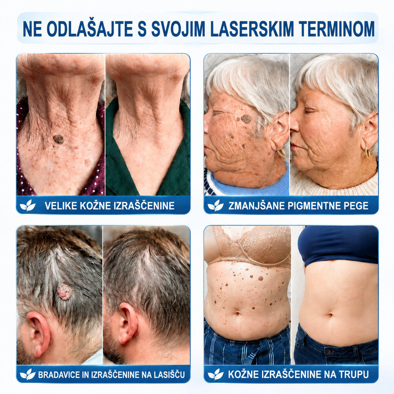 Uradna trgovina|✅️👩‍⚕️𝐇𝐈𝐒𝐊𝐈𝐍®7 dnevni odstranjevalec kožnih izrastkov in madežev(𝐫𝐨𝐥𝐥-𝐨𝐧 𝐚𝐩𝐥𝐢𝐤𝐚𝐭𝐨𝐫: 𝐛𝐫𝐞𝐳 𝐛𝐨𝐥𝐞č𝐢𝐧 𝐢𝐧 𝐛𝐫𝐚𝐳𝐠𝐨𝐭𝐢𝐧)🌳