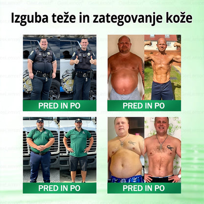 🌴Registrirano pri JAZMP in GMP certificirano👩‍⚕️🎁 𝐆𝐞𝑒𝐿𝑒𝐦𝐨𝐧® 𝐆𝐥𝐮𝐦𝐚𝐬𝐞𝐭𝐢𝐝𝐞 8 v 1 Hujševalni in zdravju namenjen nano obliž z mikroiglicami 🇸🇮 (Samo enkrat na dan, vidne spremembe že v 7 dneh) ✅