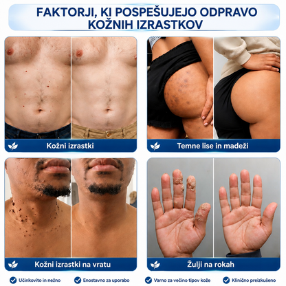 𝐇𝐈𝐒𝐊𝐈𝐍® 𝟕-𝐝𝐧𝐞𝐯𝐧𝐚 𝐤𝐫𝐞𝐦𝐚 𝐳𝐚 𝐤𝐨ž𝐧𝐞 𝐢𝐳𝐫𝐚𝐬𝐭𝐤𝐞 & 𝐩𝐢𝐠𝐦𝐞𝐧𝐭𝐧𝐞 𝐦𝐚𝐝𝐞ž𝐞 (𝐧𝐞𝐛𝐨𝐥𝐞č𝐚 𝐟𝐨𝐫𝐦𝐮𝐥𝐚 – 𝐛𝐫𝐞𝐳 𝐛𝐫𝐚𝐳𝐠𝐨𝐭𝐢𝐧) 🎉