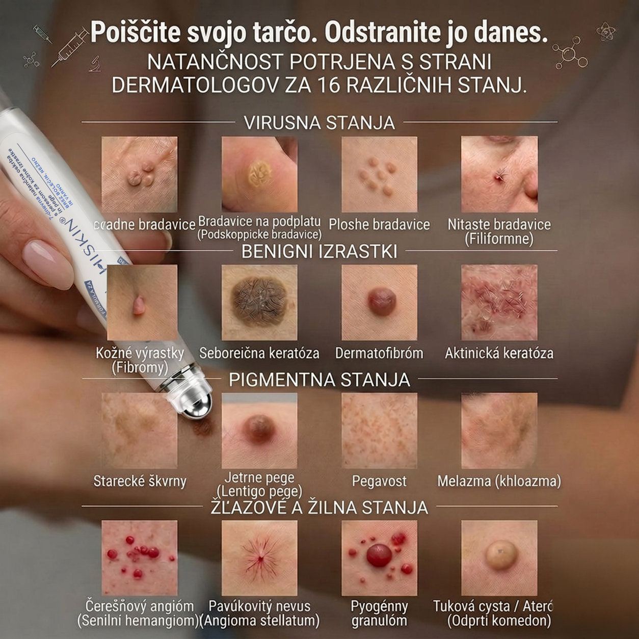 Uradna trgovina|✅️👩‍⚕️𝐇𝐈𝐒𝐊𝐈𝐍®7 dnevni odstranjevalec kožnih izrastkov in madežev(𝐫𝐨𝐥𝐥-𝐨𝐧 𝐚𝐩𝐥𝐢𝐤𝐚𝐭𝐨𝐫: 𝐛𝐫𝐞𝐳 𝐛𝐨𝐥𝐞č𝐢𝐧 𝐢𝐧 𝐛𝐫𝐚𝐳𝐠𝐨𝐭𝐢𝐧)🌳